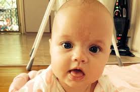 Ideal for your own pet's wardrobe or as a neat gift for a dog or cat mom you know. Beckwith Wiedemann Syndrome Signs And Symptoms