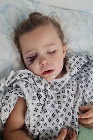 Mum 'felt sick' after toddler suffers horror injuries in dog attack