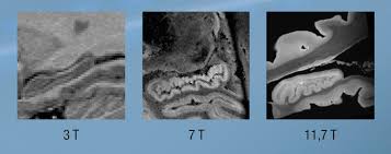 Chaque centre propose à nos patients. English Portal Travel Of The Largest And Most Powerful Mri Magnet In The World