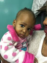 Live from Swaziland ... it's Saturday morning!: 18-month-old baby girl is  the size of a 5-month-old