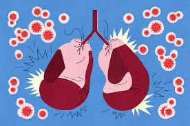 To Fight Covid 19 Don T Neglect Immunity And Inflammation The New York Times