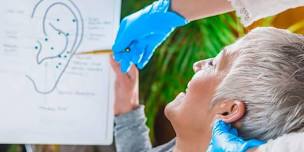 June Auriculotherapy with Revive Ear Seeds and Acupuncture