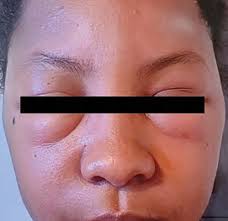 What's Your Diagnosis?