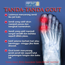 Berikut penyebab dan cara menghilangkannya. Aafiyat Lifestyle Apa Tanda Tanda Gout Tanda Tanda Gout Lazimnya Menyerang Sendi Ibu Jari Kaki Sendi Yang Sakit Menjadi Sangat Sensitif Dan Berbisa Seperti Dihiris Pisau Sakit Selama Berhari Hari Atau