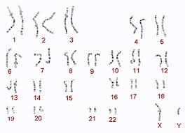 Ort) versteht man in der genetik eine chromosomenmutation, bei der chromosomenabschnitte an eine andere position innerhalb des chromosomenbestandes verlagert. Leona E V Familienselbsthilfe Bei Seltenen Chromosomenveranderungen Einfuhrung Zu Chromosomen Storungen