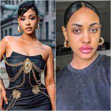 Tanasha Donna to remove lip fillers