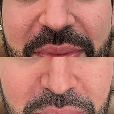 Injector Artist by Heather DeRoche