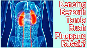 Ia lebih kerap berlaku di kalangan berumur (tiga kali ganda berbanding golongan muda). Tanda Buah Pinggang Rosak 3 Cara Mengatasi Youtube