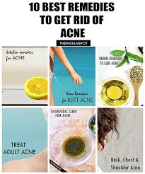Maybe you would like to learn more about one of these? 10 Best Home Remedies To Get Rid Of Acne