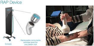 Astanza laser is the only cosmetic laser manufacturer with a specialized background in laser tattoo removal technology. Soliton A Solid Play On The Tattoo Removal Opportunity In 2020 Nasdaq Soly Seeking Alpha