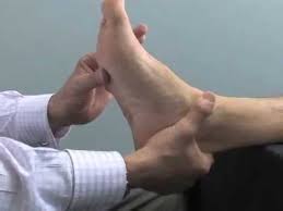 Cuboid syndrome often results from injury or overuse and is more common in athletes and dancers. Cuboid Manipulation Howard Dananberg Dpm Youtube