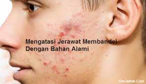 Sama halnya seperti toner air beras, masker kunyit berfungsi untuk menghilangkan noda gelap bekas jerawat. Cara Mengatasi Jerawat Membandel Di Wajah Dengan Bahan Alami Omjamal Com