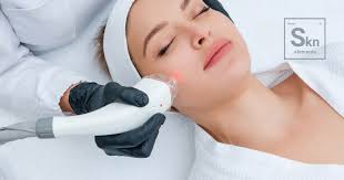 Caleb McGrew, Author at Skn Elements