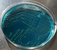 Image result for Shigella