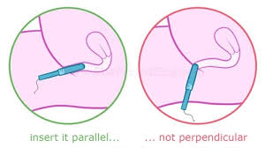 You may be able to see the white cotton end of the tampon poking through one end of the applicator. What Is A Good Diagram That Shows How To Insert A Tampon Quora