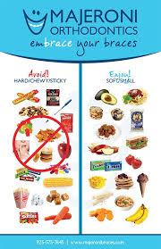 Getting Braces Majeroni Orthodontics Braces Food Getting Braces Orthodontics Braces
