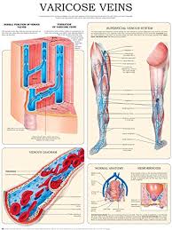 varicose veins e chart quick reference guide ebook hc