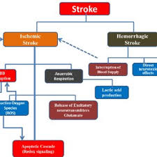 Image result for Stroke Pathophysiology
