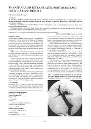 Tan goh & associates is a lawyer firm located in seremban, sembilan with 4 practicing lawyer. Pdf Transjugular Intrahepatic Portosystemic Shunt A Case Report