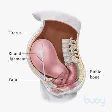 Round Ligament Pain In Pregnancy | Why It Happens | Buoy