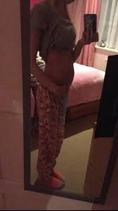 The first is that endo belly accompanies a. Endo Belly Endo Belly Tonight I M In Endometriosis Uk