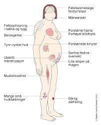 Lær definisjonen av godartet svulst. Cushings Syndrom Nhi No