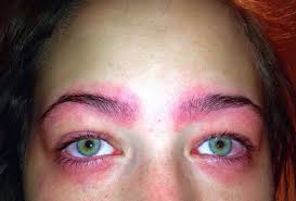Put down the lash serum and step away from the mascara, here's everything to know. Eyebrow Tinting Gone Wrong Teen Experiences Severe Reaction To Home Dye Kit