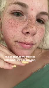 don’t say a word abt my brows #fyp #fypage #blonde #fypシ゚viral #foryou  #fypシ #freckles