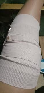 Bungkus setiap potongan di sekitar area tepat di atas dan di bawah sendi yang cedera atau patah di tulang, termasuk jari buddy di pembungkus. Verban Elastis 3 In Elastic Bandage 3 Inch Verban Pembalut Patah Tulang 3 Inci 3 Perban Elastis 3 In Verban Elastis 3in Verban Elastis 3inci Verban Elastis 3inch Perban Patah Tulang 3inchi