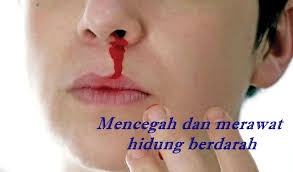 Hidung berdarah merupakan satu daripada simptom tekanan darah yang tinggi. Vitamin Sana Sini Selsema Punca Hidung Berdarah Bahaya Atau Tidak