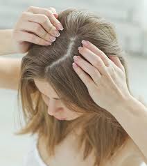 Your style of hair can cause hair loss when your hair is arranged in ways that pull on your roots, like tight ponytails, braids, or corn rows. Does Diabetes Cause Hair Loss Causes Treatment And Prevention