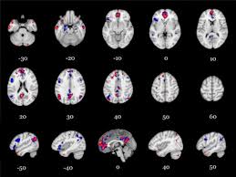neuroimaging the consciousness of self