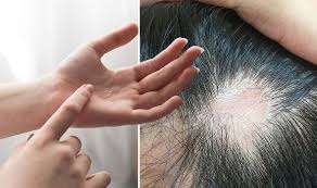 These products are for men and women and they will help improve your hair quality. Losing Hair Applying This Natural Solution Generated Hair Growth Within Three Months Amis Childrenshome