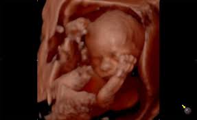 Beyond the eighth week of pregnancy, the embryo is called a fetus. Pregnancy Ultrasounds 2d 3d 4d And 5d Hd