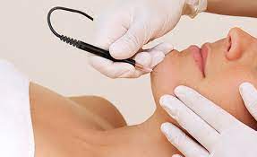 To get a fast and less painful hair removal process, a laser is a good option. Everything You Need To Know Before You Get Electrolysis Hair Removal Kosmoderma Skin Hair Clinics