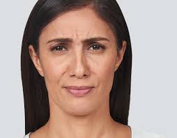 BOTOX® Cosmetic — Better Health Medical