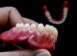 Pin By Ilker Kurt On Monavale Family Dental Dental Family Dental Dental Technician