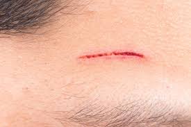 Check spelling or type a new query. Type 2 Diabetes Symptoms Early Signs And Complications
