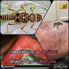 يواجه العلماء في استراليا وباء يتصاعد بتسارع ملحوظ ولم يتم التوصل إلى كيفية صد هذا المرض الغامض المسمى قرحة بورولي أو buruli ulcer فقد تم movie posters movies