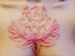 James rajewski scarification body modification 1 of 2. Extreme Body Modification Scar Art Gallery