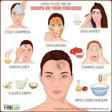 How To Get Rid Of Bumps On Forehead Forehead Bumps Forehead Acne Pimples On Forehead