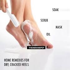Cracked heels, the most embarrassing foot problem. Home Remedies For Dry Cracked Heels The Indian Spot