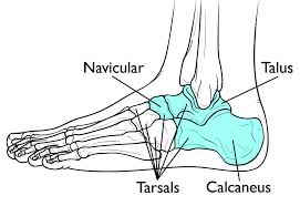 Red marrow fills the spaces in the spongy bone. Tarsal Coalition Orthoinfo Aaos