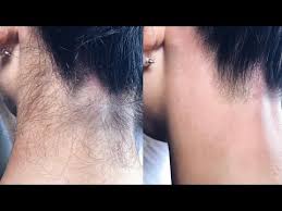 For services, you may book at your body's retreat in hurst, texas or south florida sugaring in lauderhill, florida. Professional Waxing Videos Jobs Ecityworks