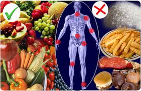 diet nutrition and supplements for osteo arthritis and