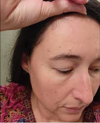 It's just a wisdom spot." — Laura Rice Ownby