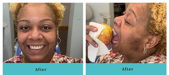 Root Canal Therapy Hamden CT