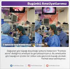 Dogustan Goz Kapagi Dusuklugu Pitozis Tedavisini Frontale Asma Dedigimiz Ameliyat Ile Gerceklestiriyoruz Bu Ameliyatta Goz Kapaginin Icin Kas Bilgi Gozler