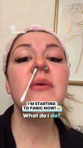 Nose Waxing Hack Goes Horribly Wrong