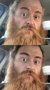 agefilter #agedifference #hairline #vegeta #dbz #dragonball #dragonba...